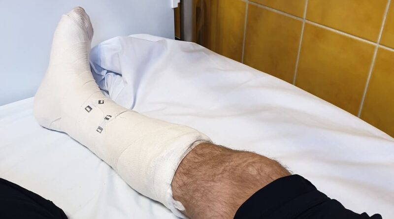 złamana noga prezydenta Jaśkowiaka fot. J. Jaśkowiak FB